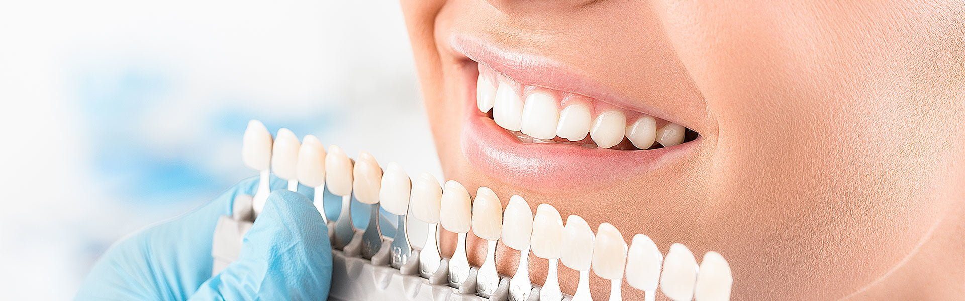 Dental Veneers in WA Bright Smile Dental
