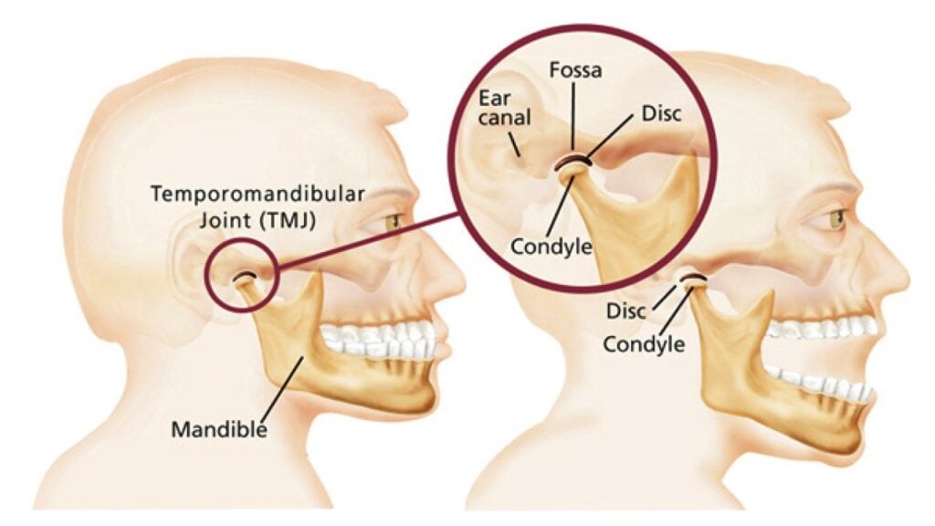 TMJ/TMD Treatments, Clicking or Popping Jaw Solutions in Lisle, IL